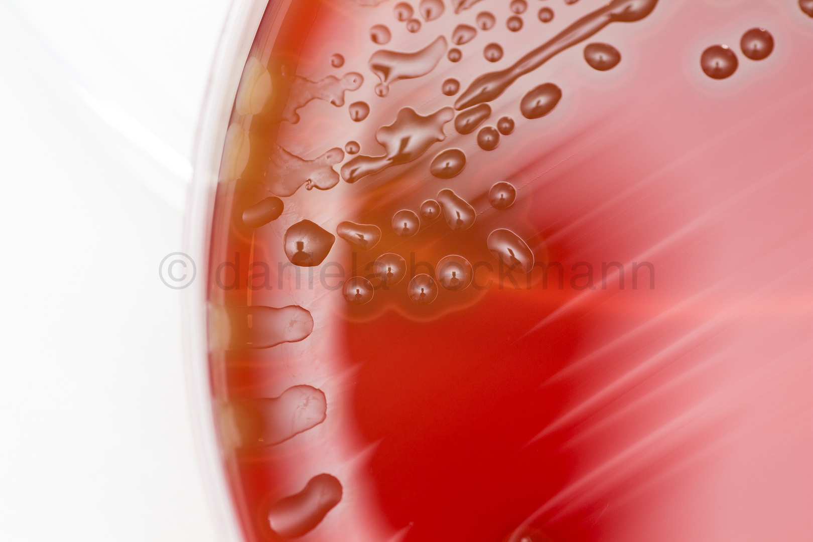 Streptococcus pneumoniae