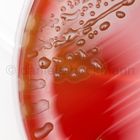 Streptococcus pneumoniae