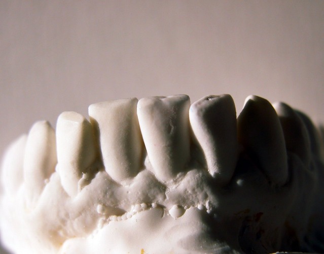 Teeth