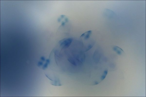 Teilchen oder Welle?