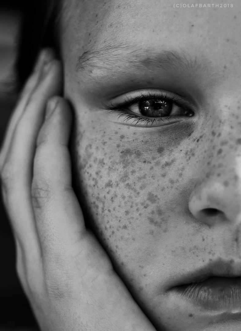 The Face and his Freckles 