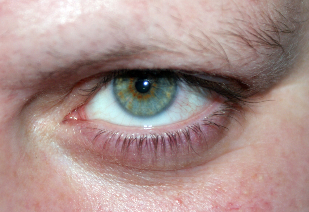 the wifes eye