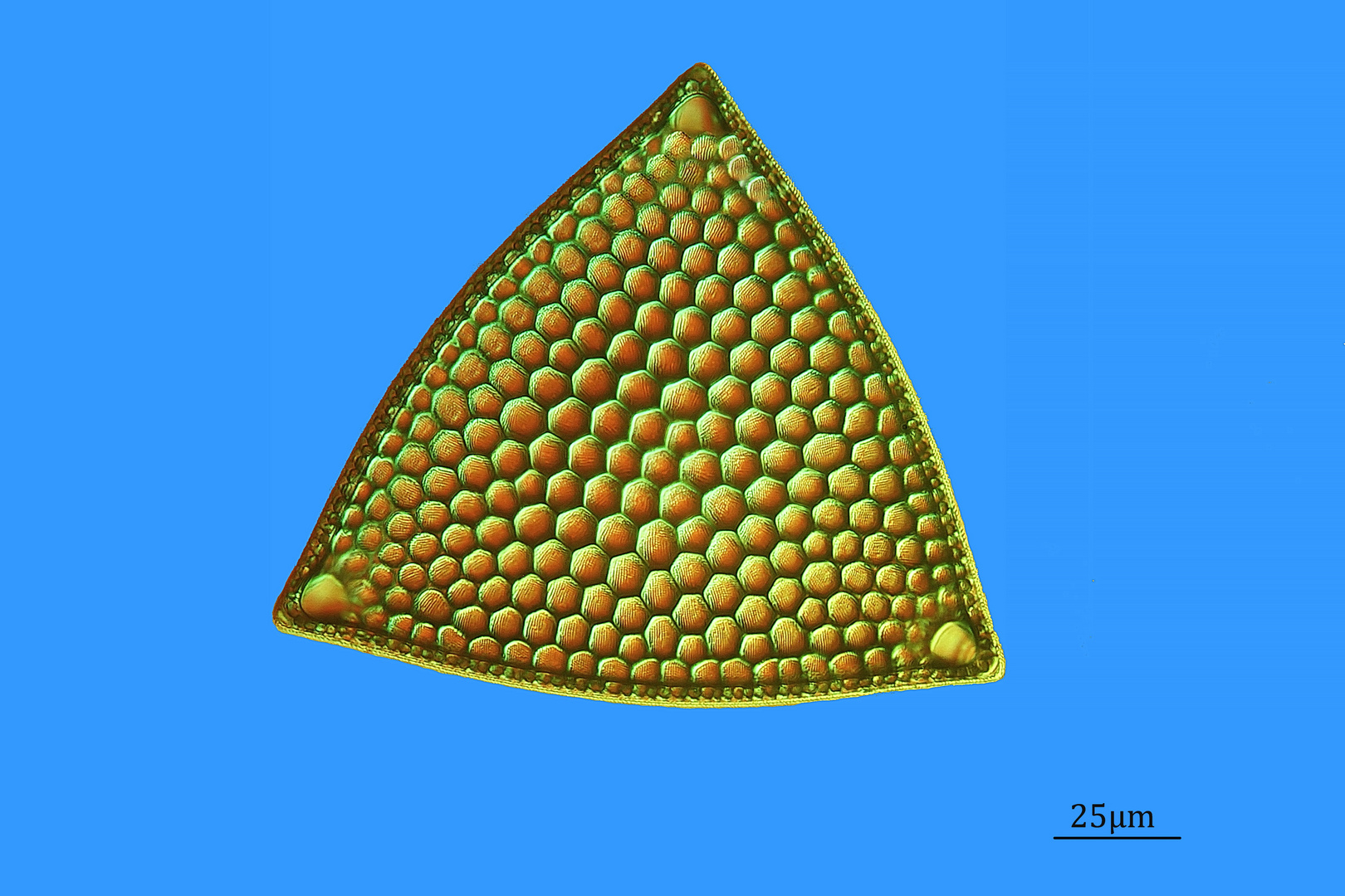  Triceratium favus mit Rheinbergbeleuchtung