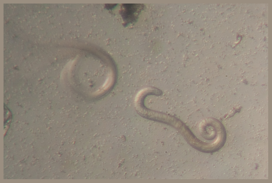 Trichinella spiralis