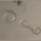 Trichinella spiralis