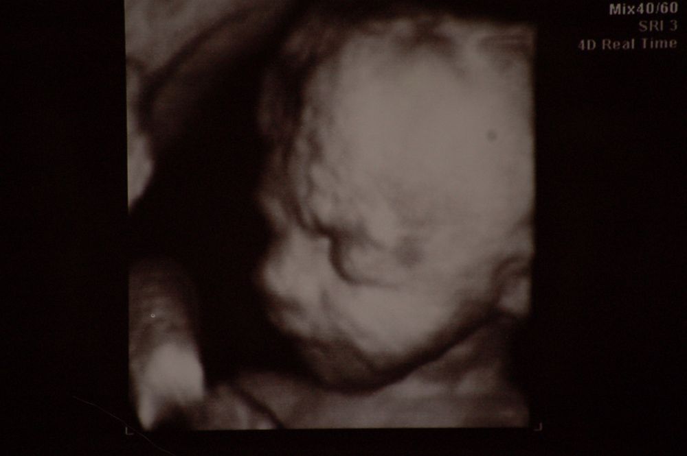 Unser Baby in 3D