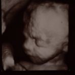 Unser Baby in 3D