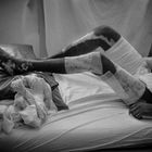 War victim burned skin through rocket attack from Gaddhafi troops, Hospital Benghasi