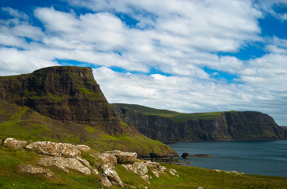 Waterstein Head