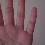 Wieviele Teile hat dein kleiner Finger?