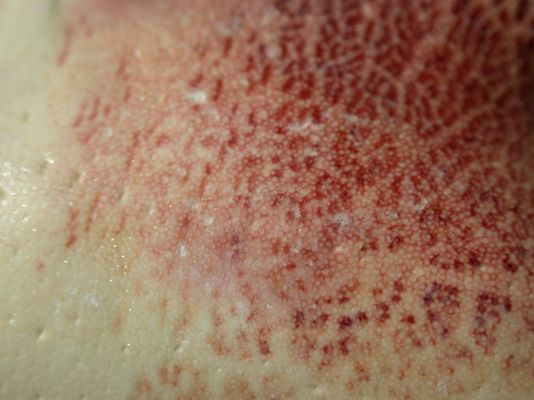 Wovon stammt der Ausschnitt???