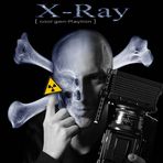 X-Ray