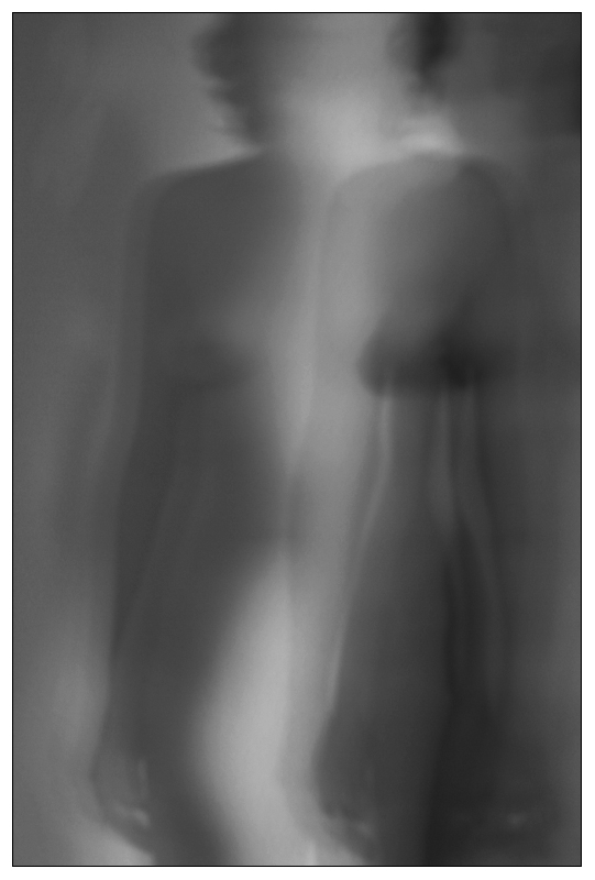 x ray