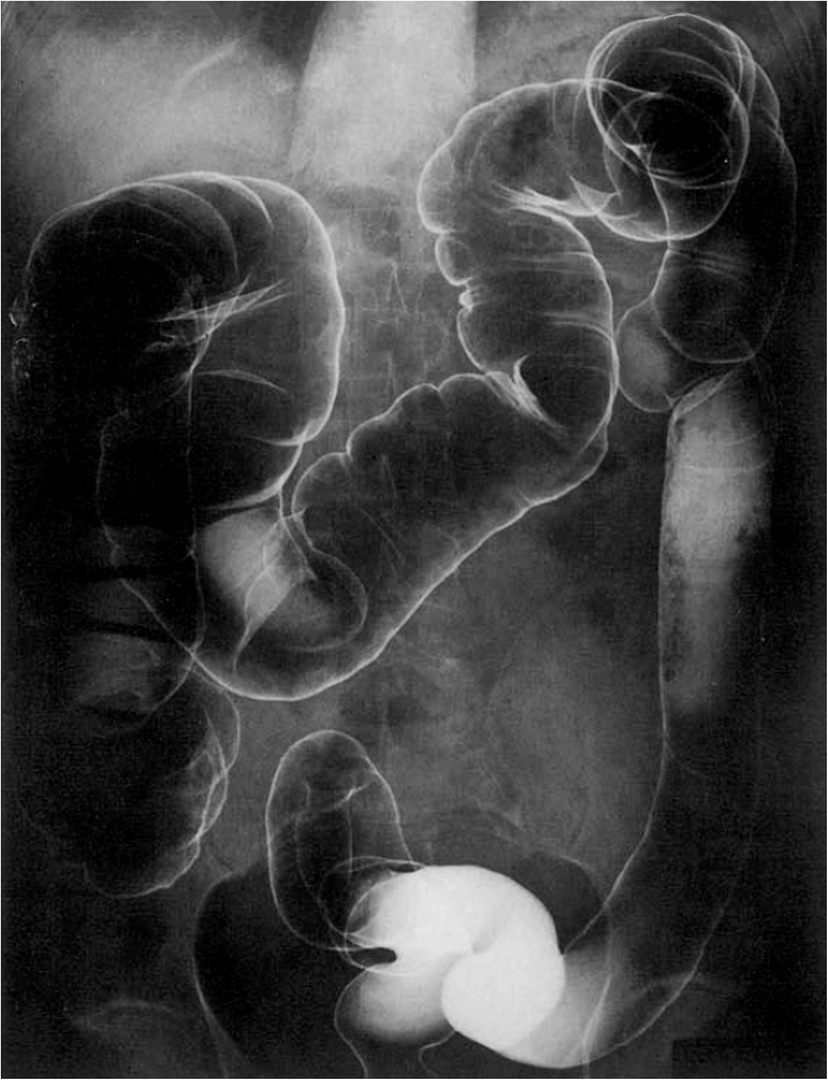 zieht euch warm an.... Foto & Bild | outdoor, menschen, erwachsene